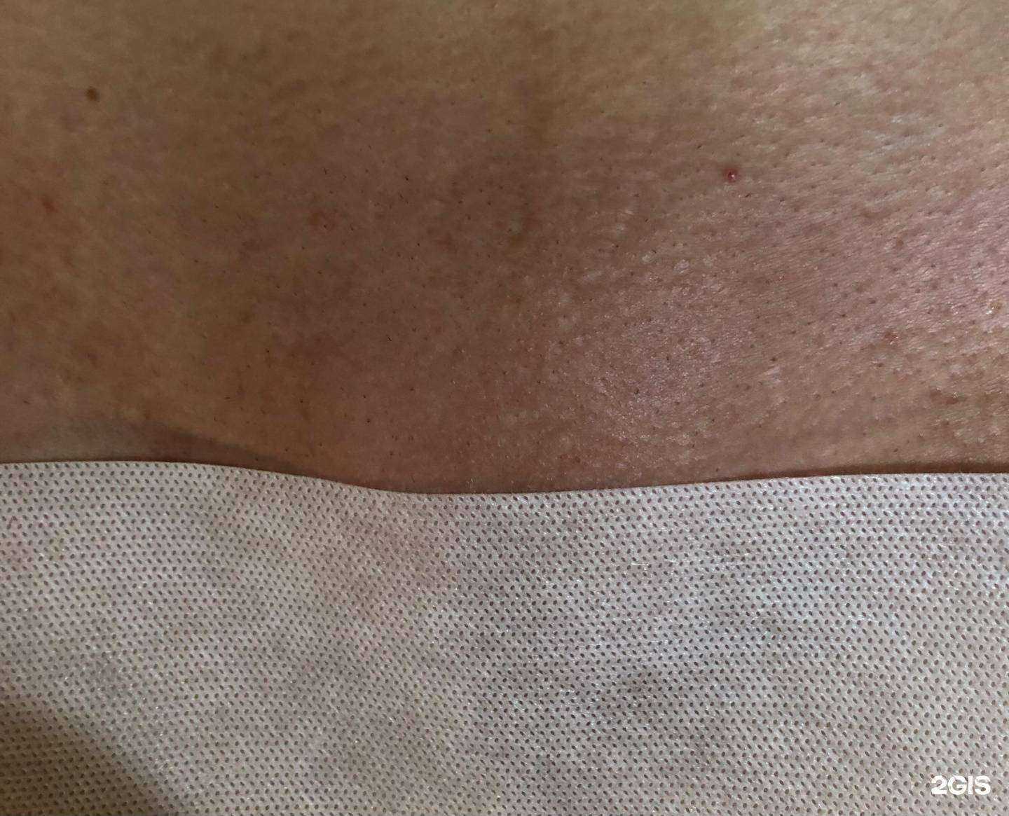 Отзывы на компанию Студия депиляции в г. Углич c фото