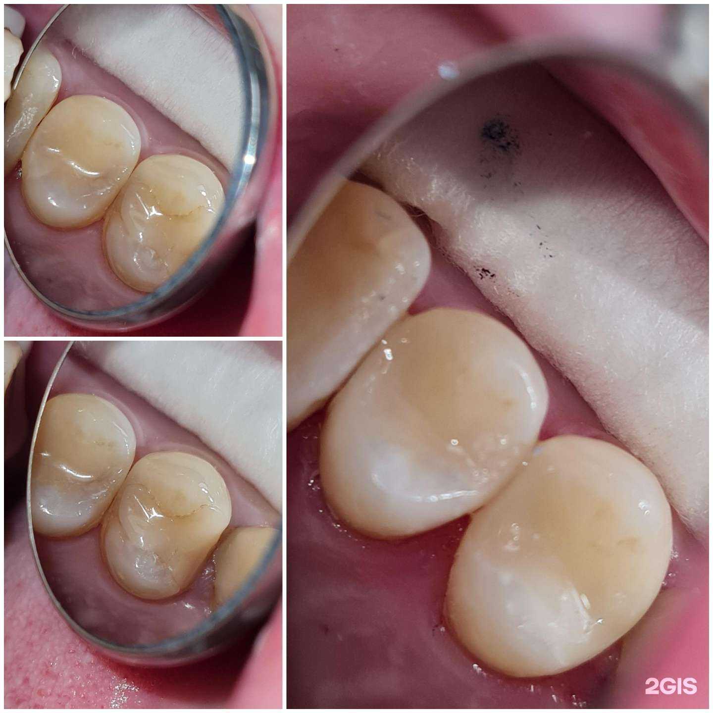 Отзывы на компанию ProfSmile в Краснодаре c фото