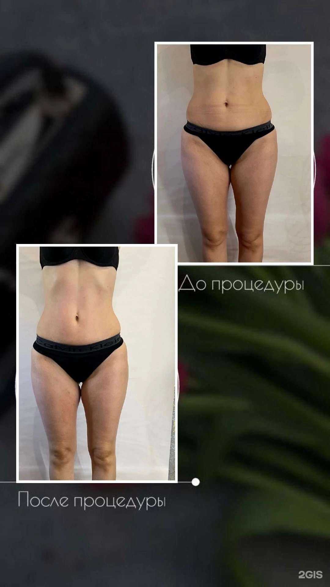 Отзывы на компанию Beauty body 89 в г. Новый Уренгой c фото