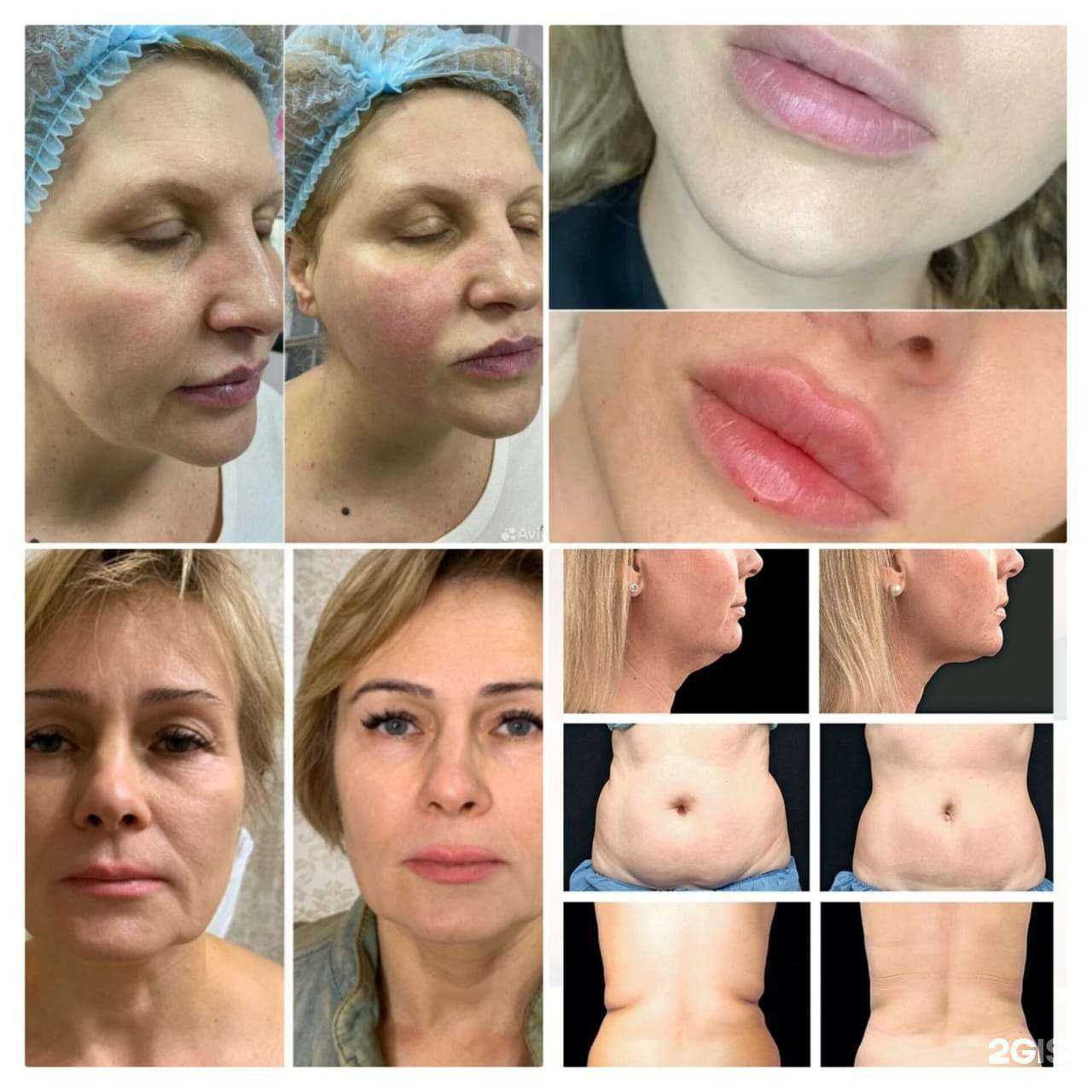 Отзывы на компанию Лолита в Норильске c фото