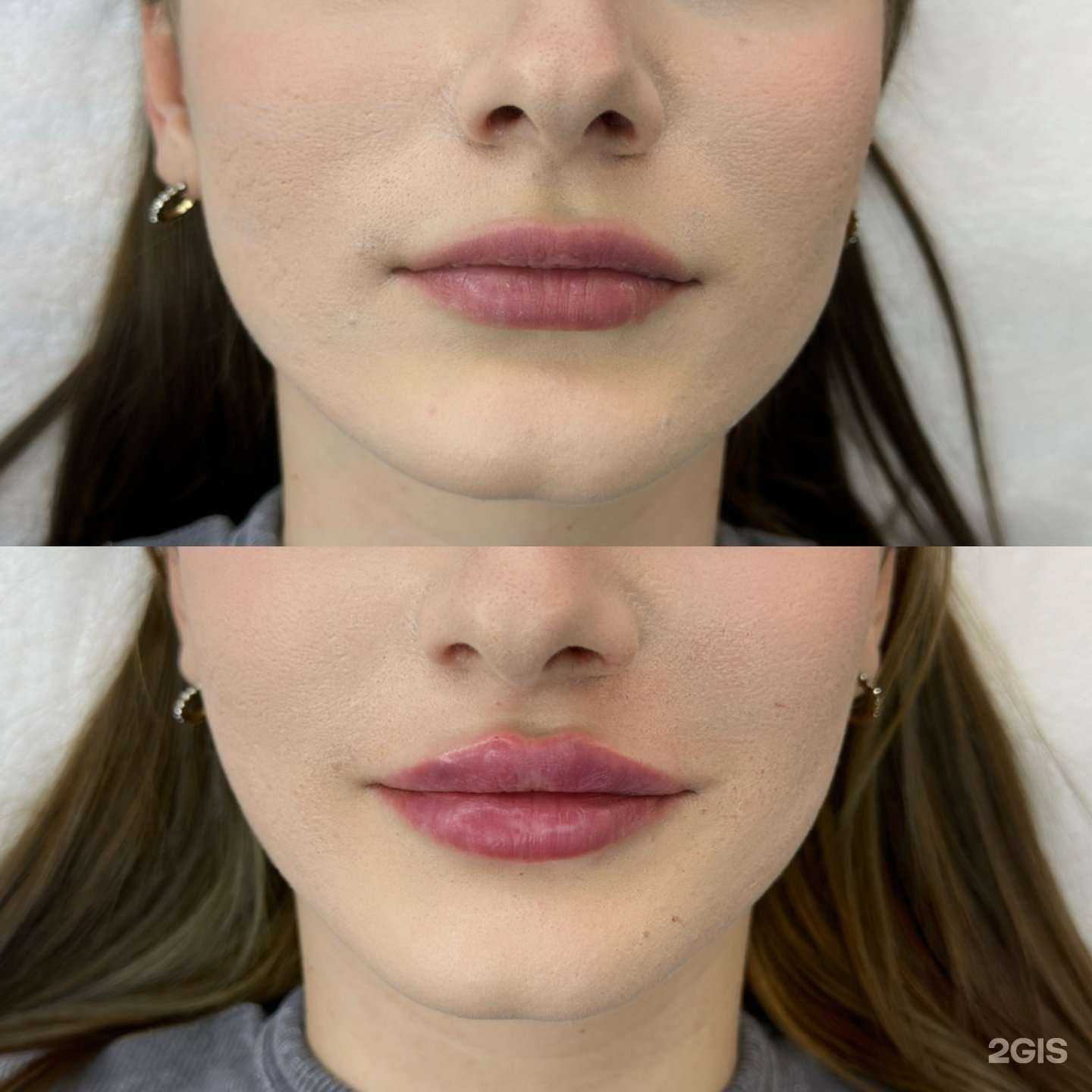 Отзывы на компанию Косметологический кабинет в Краснодаре c фото