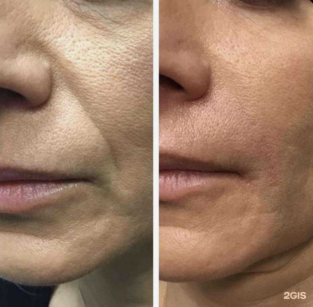 Отзывы на компанию Силуэт в Анапе c фото