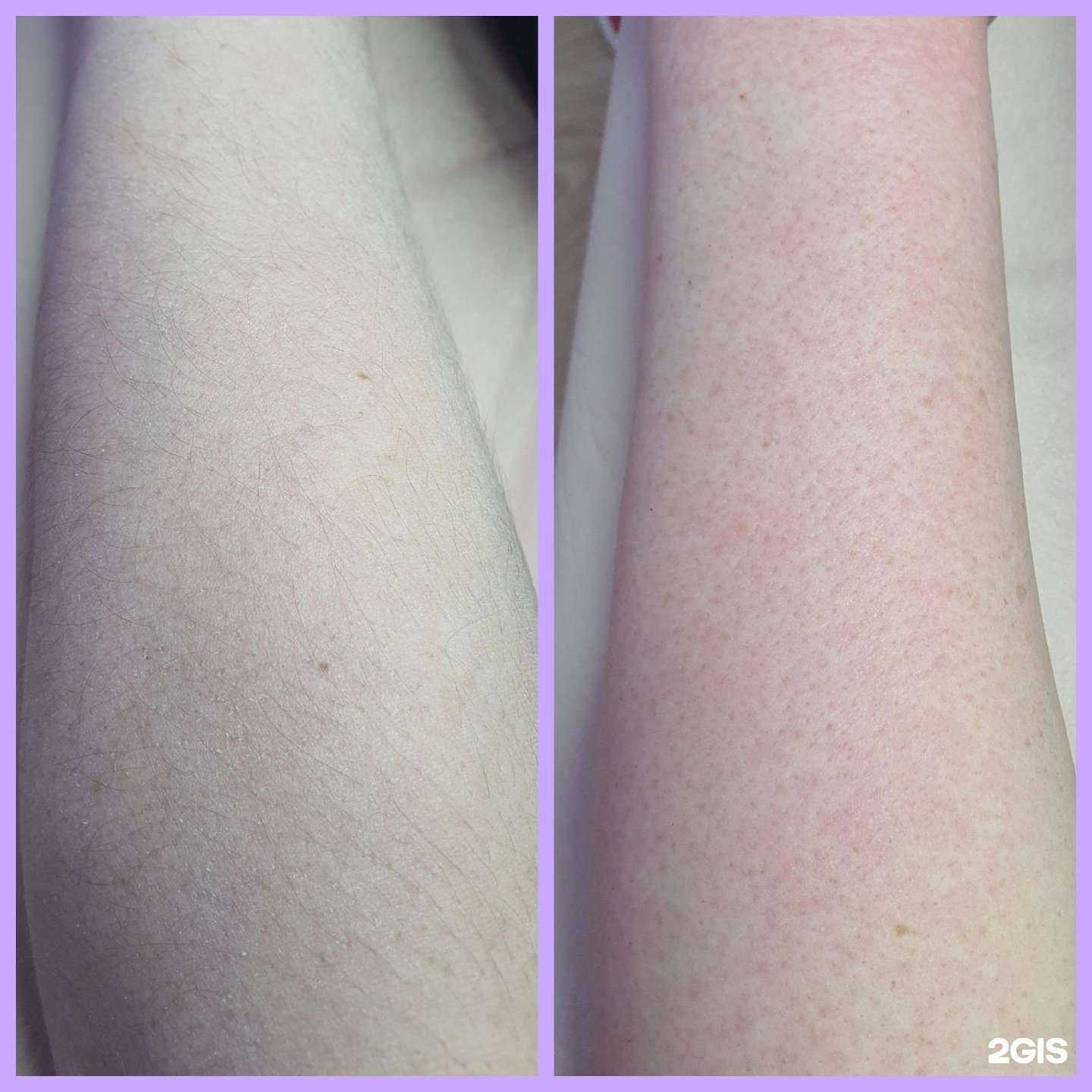 Отзывы на компанию Кабинет депиляции в г. Белая Калитва c фото