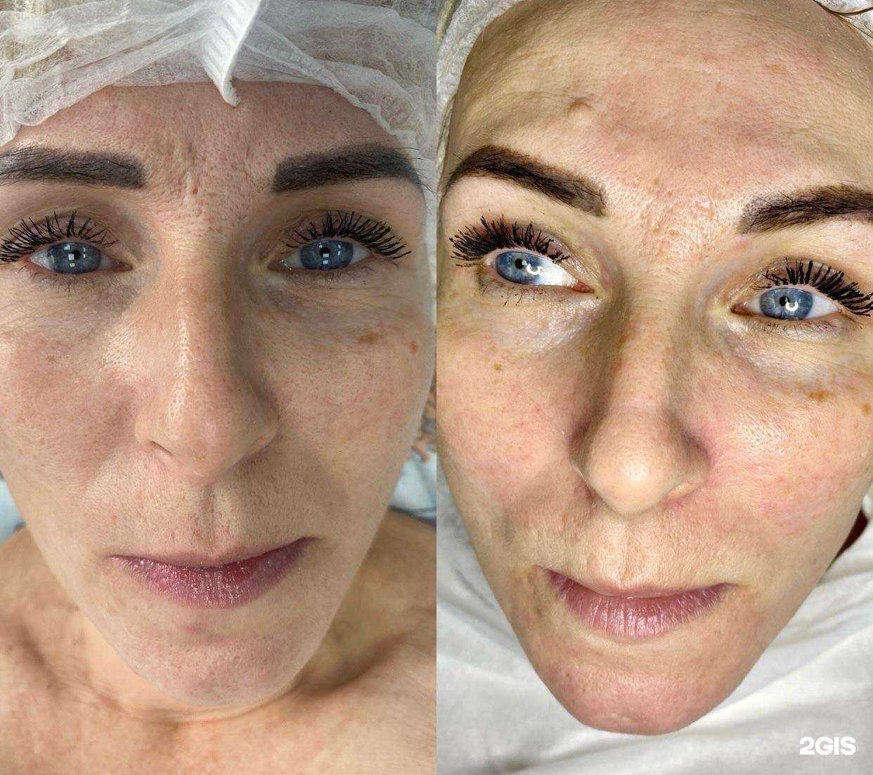 Отзывы на компанию Svet beauty studio в г. Киров c фото