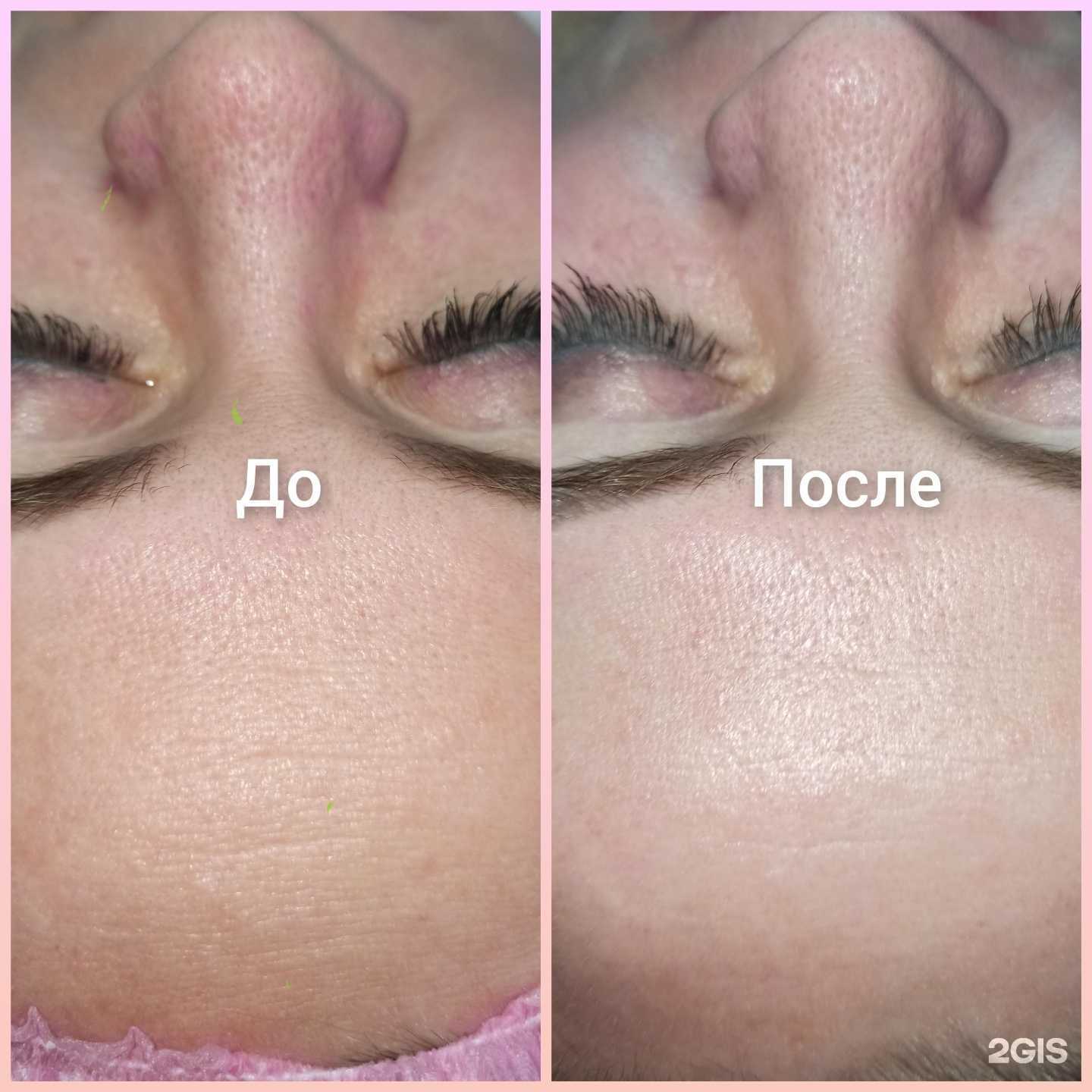 Отзывы на компанию Студия эстетики лица в Кемерове c фото