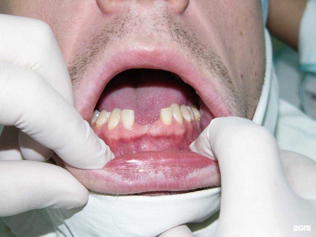 Отзывы на компанию А-Дент+ в г. Саранск c фото