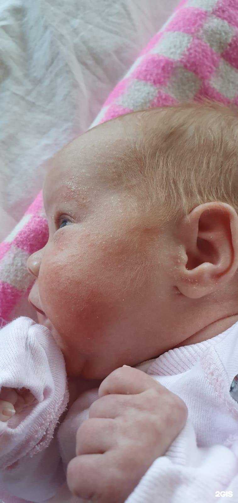 Отзывы на компанию Центр лечения аллергии в г. Набережные Челны c фото