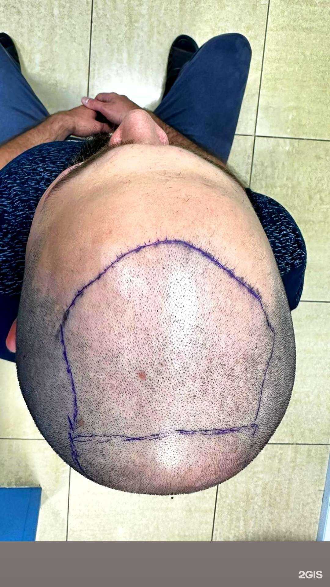 Отзывы на компанию Dr.Ibragim Hairline в Тюмени c фото