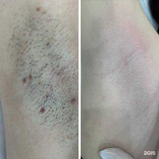 Отзывы на компанию ProfLaser в Новосибирске c фото