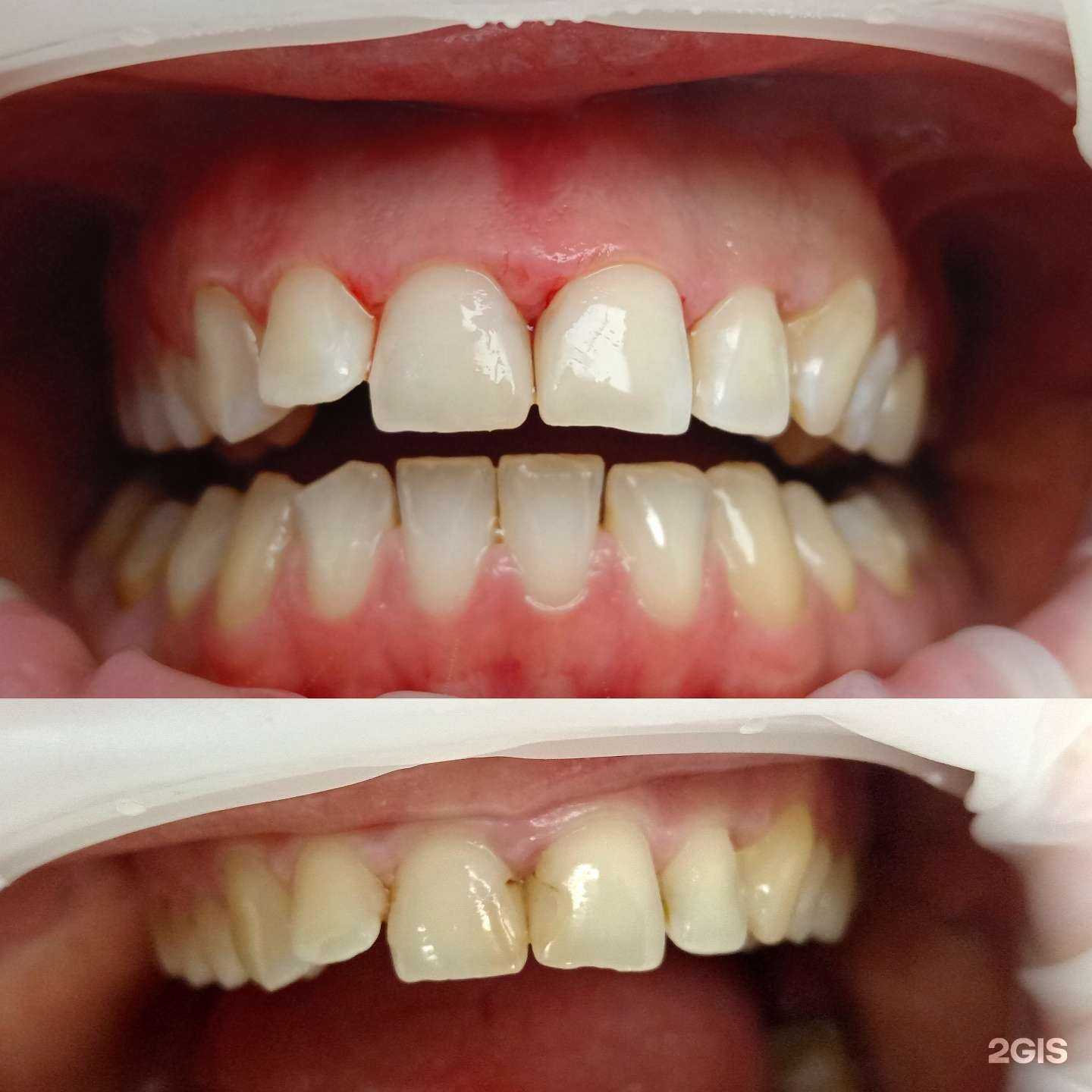 Отзывы на компанию Дентал хоум в Краснодаре c фото