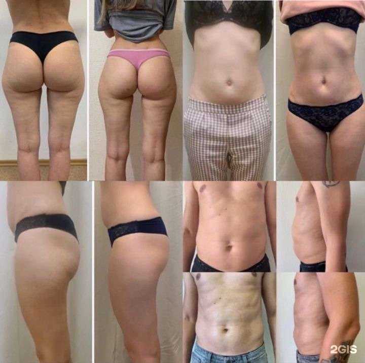 Отзывы на компанию Кабинет аппаратной коррекции фигуры и эстетической косметологии в Новосибирске c фото