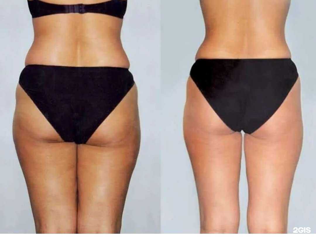 Отзывы на компанию Студия косметологии и массажа в Барнауле c фото