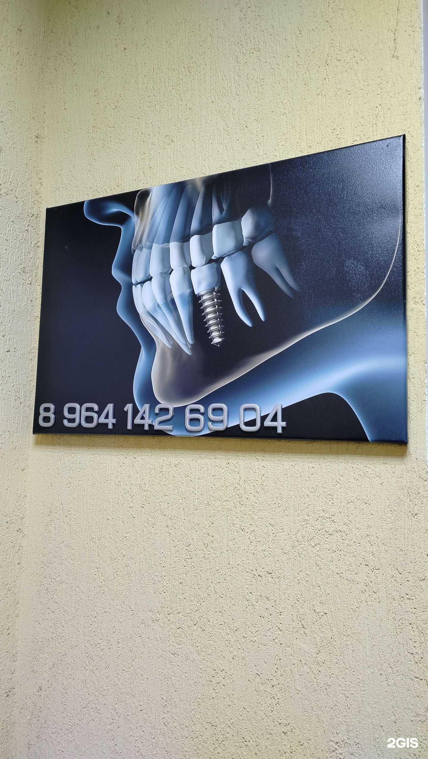 Отзывы на компанию Кабинет имплантации в Калуге c фото