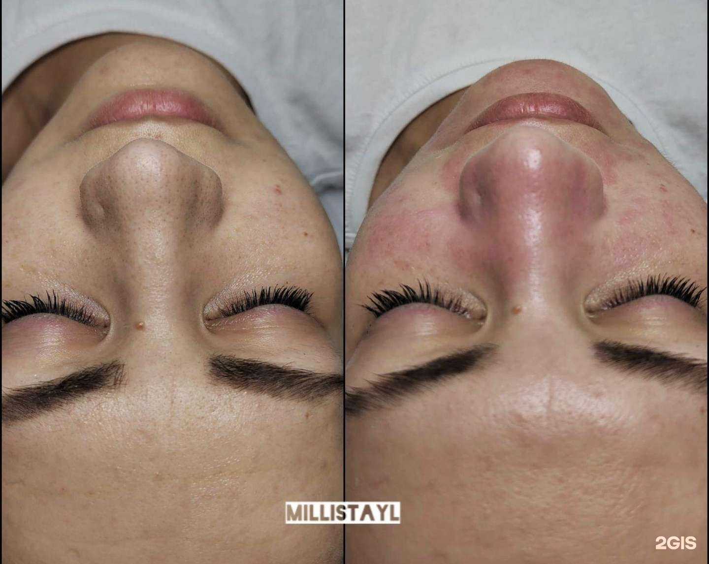 Отзывы на компанию MilliStayl в Новосибирске c фото