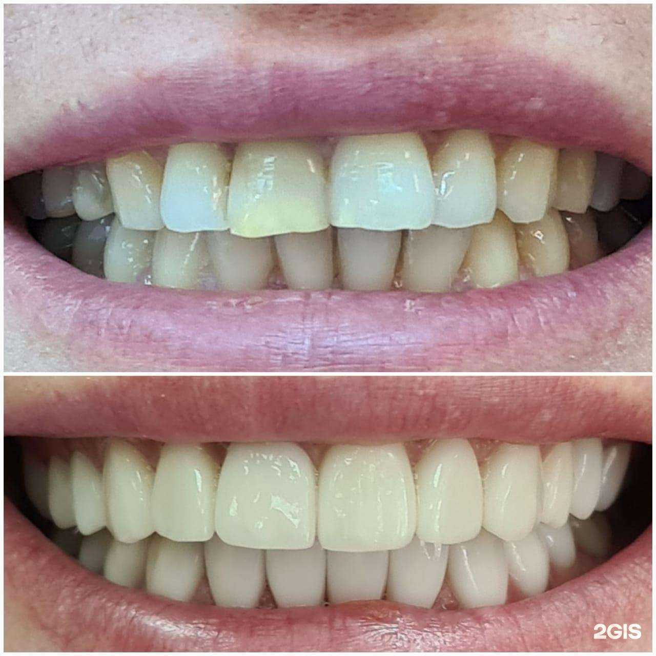 Отзывы на компанию В-Дентал в Иркутске c фото