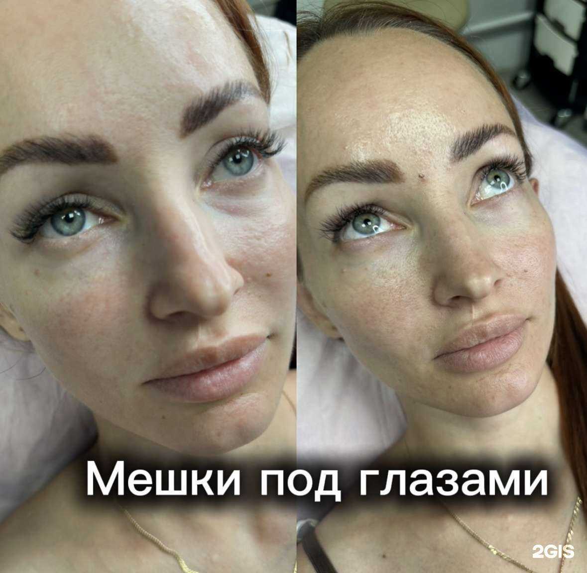 Отзывы на компанию Косметолог Vlasova в Краснодаре c фото