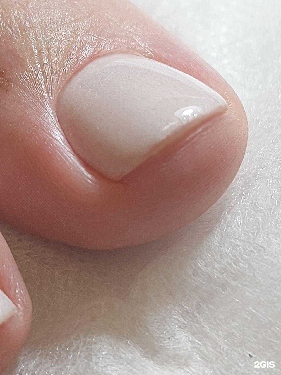 Отзывы на компанию Ecoslim в Воронеже c фото