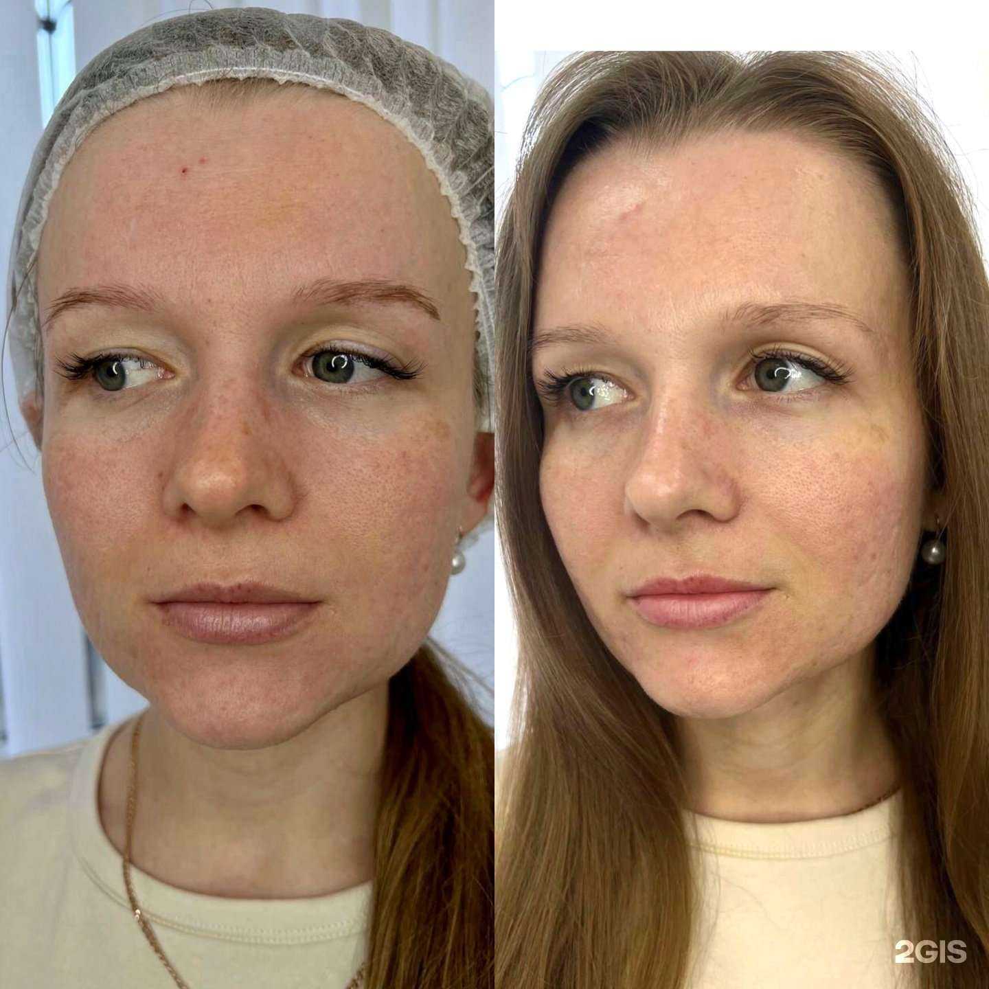 Отзывы на компанию Хороший косметолог в Ульяновске c фото