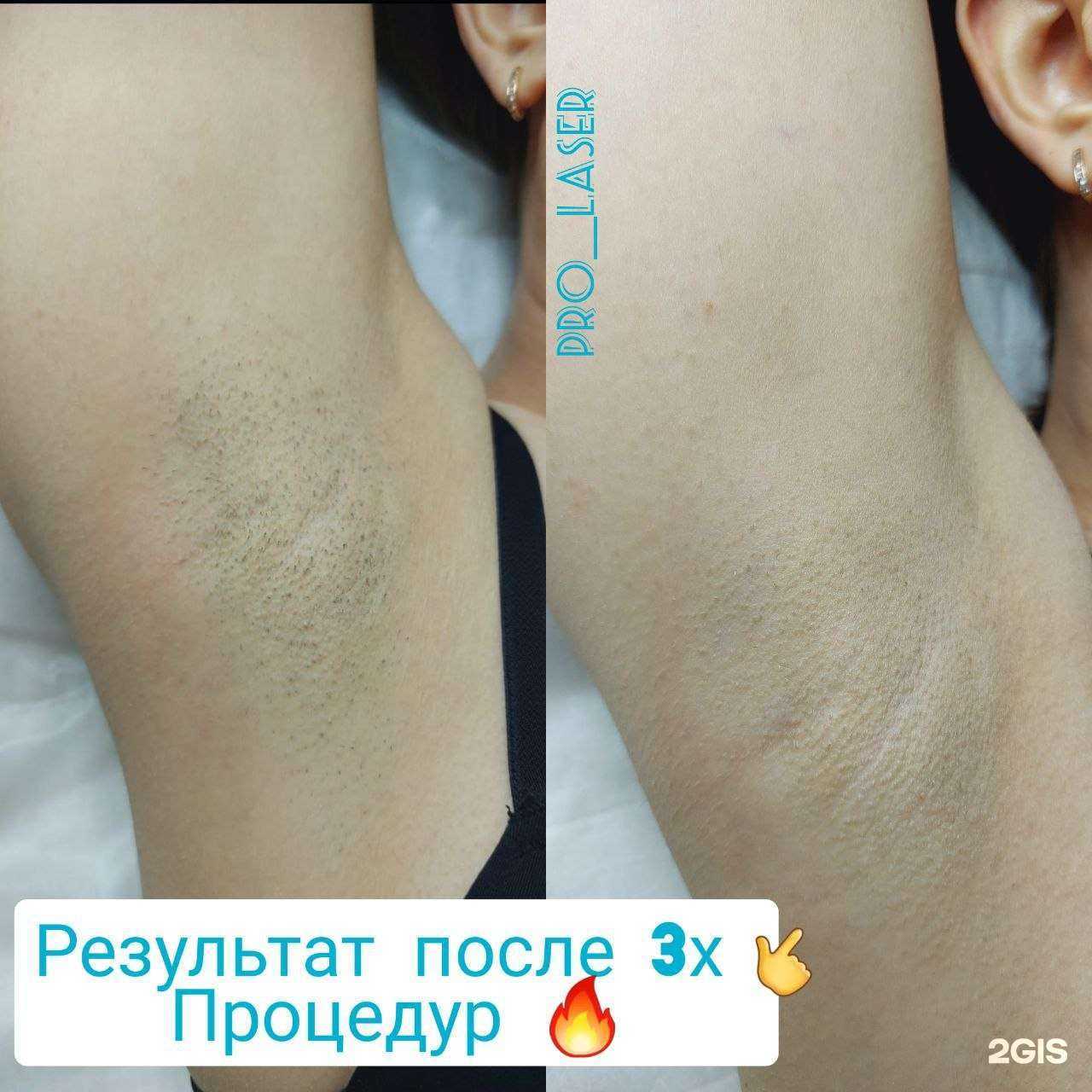 Отзывы на компанию Pro__lazer в Самаре c фото