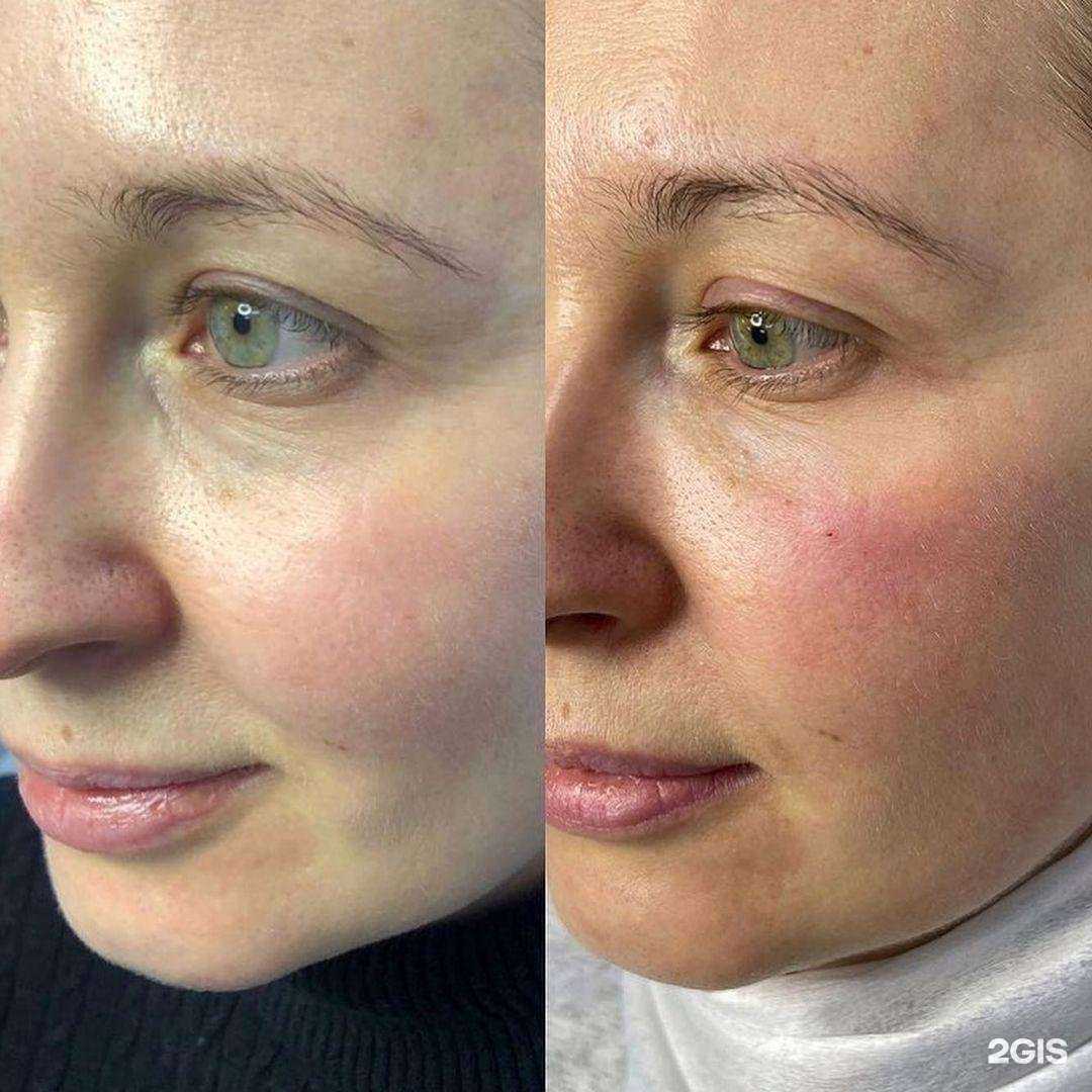 Отзывы на компанию Косметологический кабинет в Самаре c фото