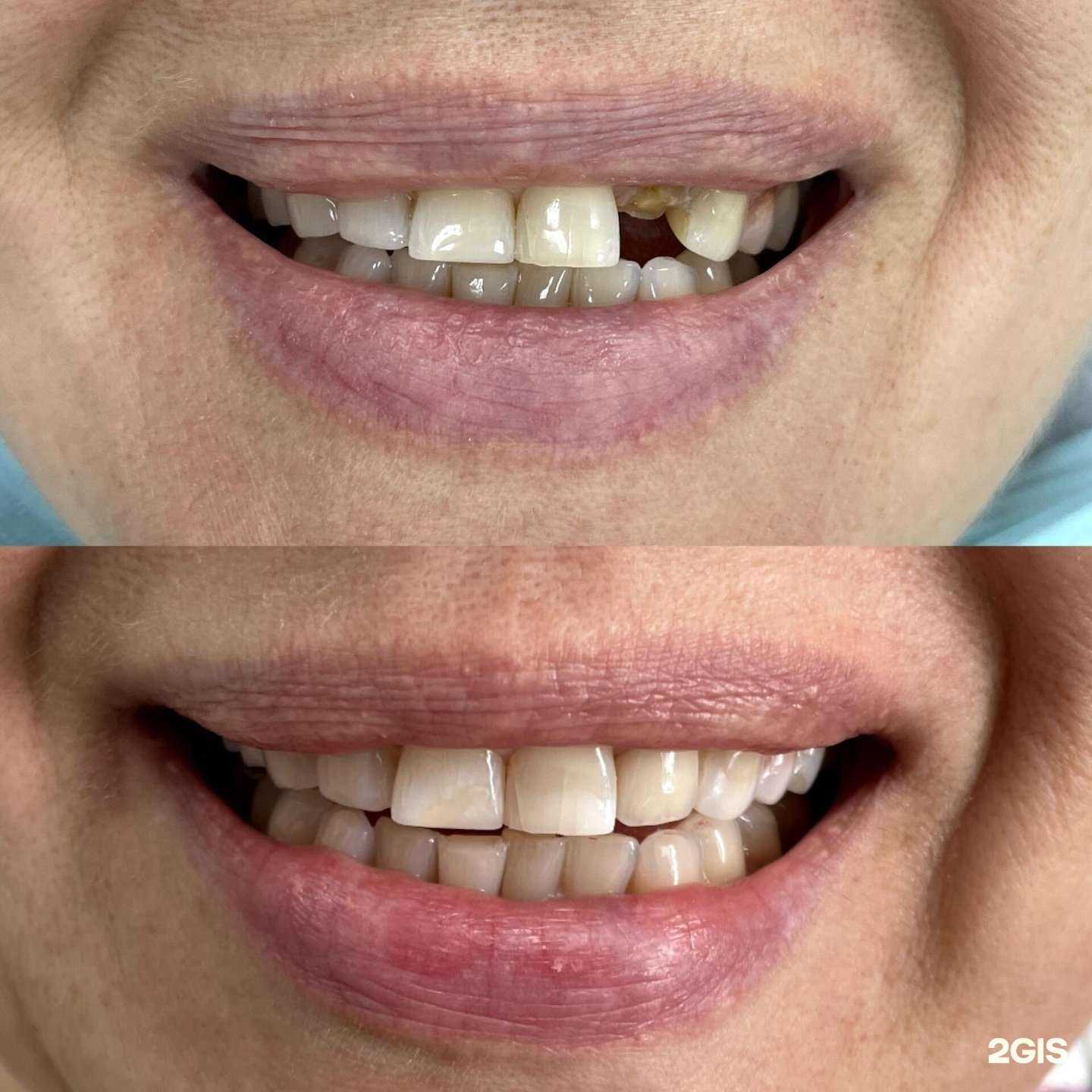 Отзывы на компанию SmileDesign в г. Нижний Новгород c фото