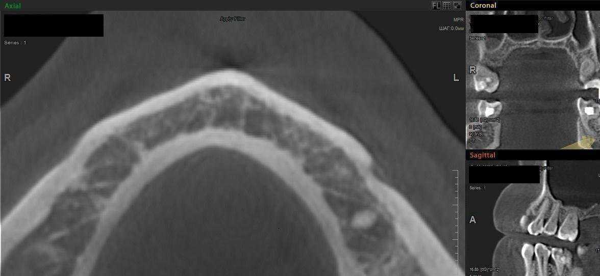 Отзывы на компанию Дента студия в г. Чебоксары c фото