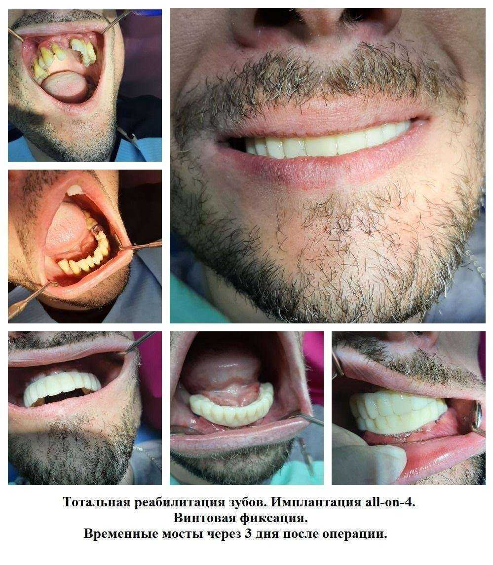 Отзывы на компанию ДентАлекс в Краснодаре c фото