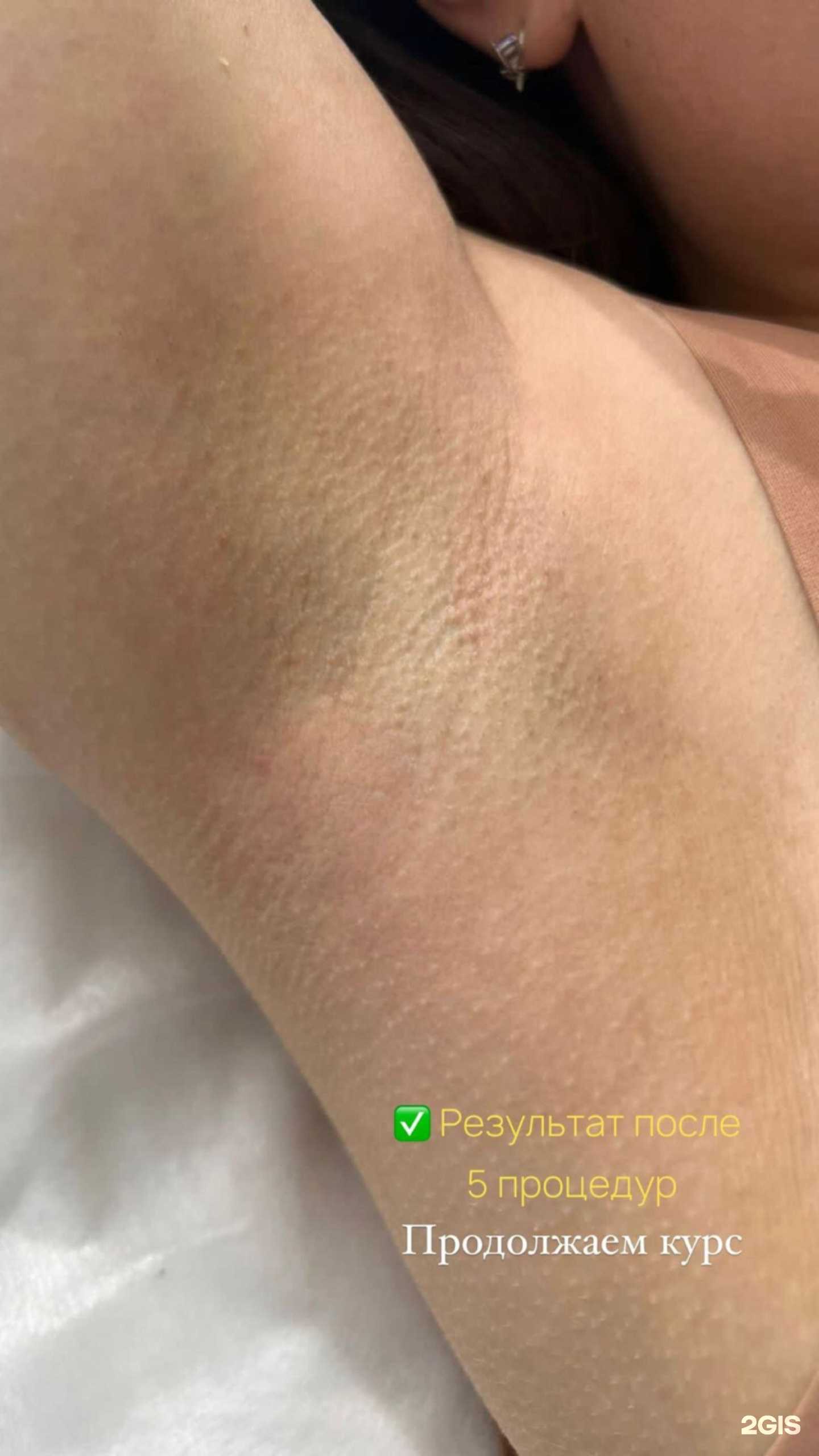 Отзывы на компанию Laser med в г. Саров c фото