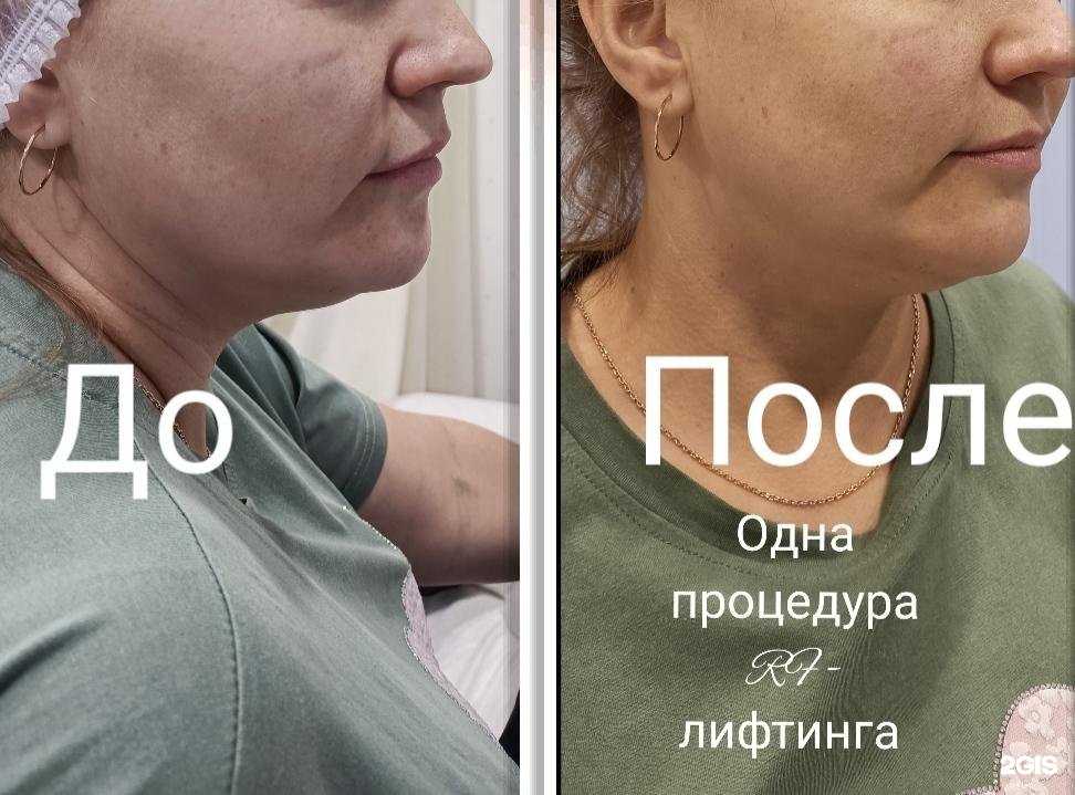 Отзывы на компанию ProTelo в г. Бердск c фото