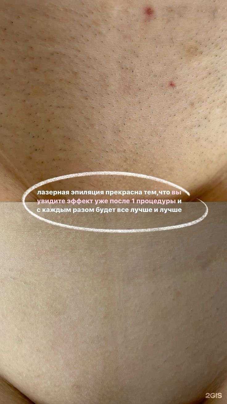 Отзывы на компанию Vip_laser_uss в Уссурийске c фото