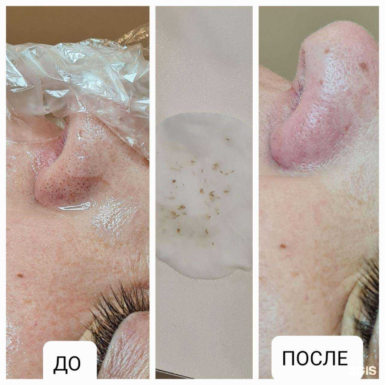 Отзывы на компанию Сила Красоты в Иркутске c фото