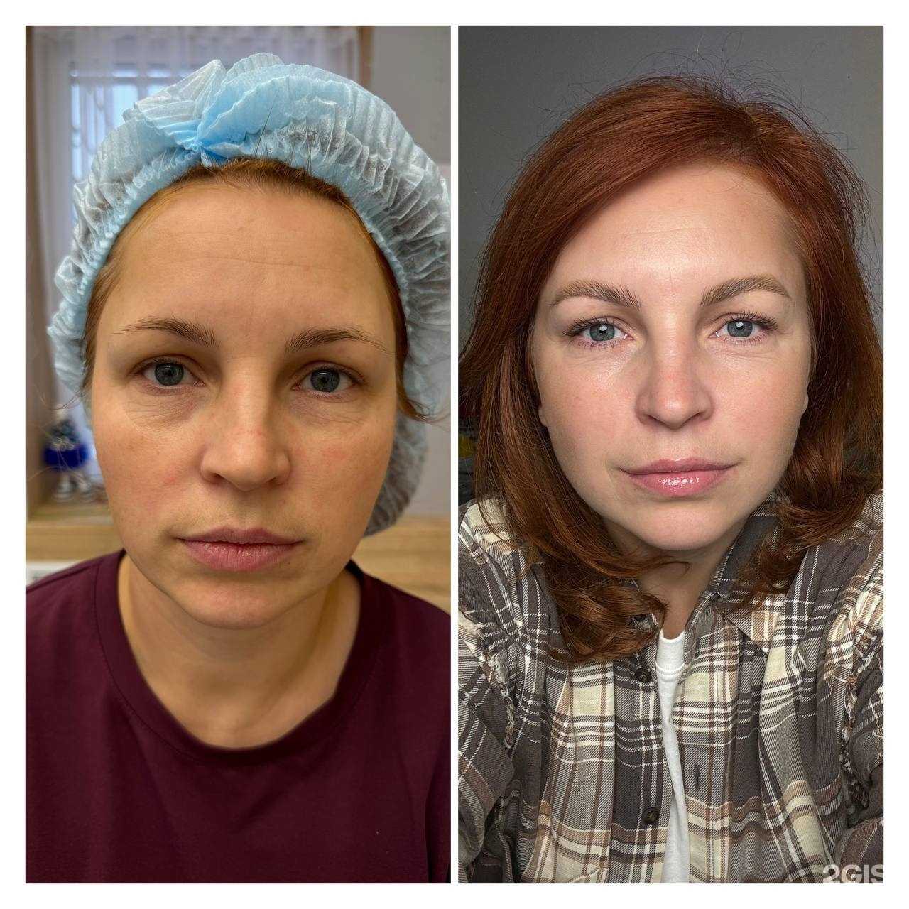 Отзывы на компанию sariyakosmetolog в г. Казань c фото