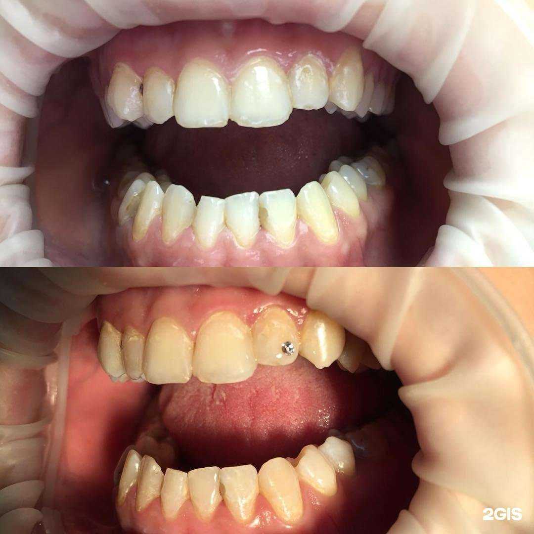 Отзывы на компанию Альфа Дент в г. Петропавловск-Камчатский c фото