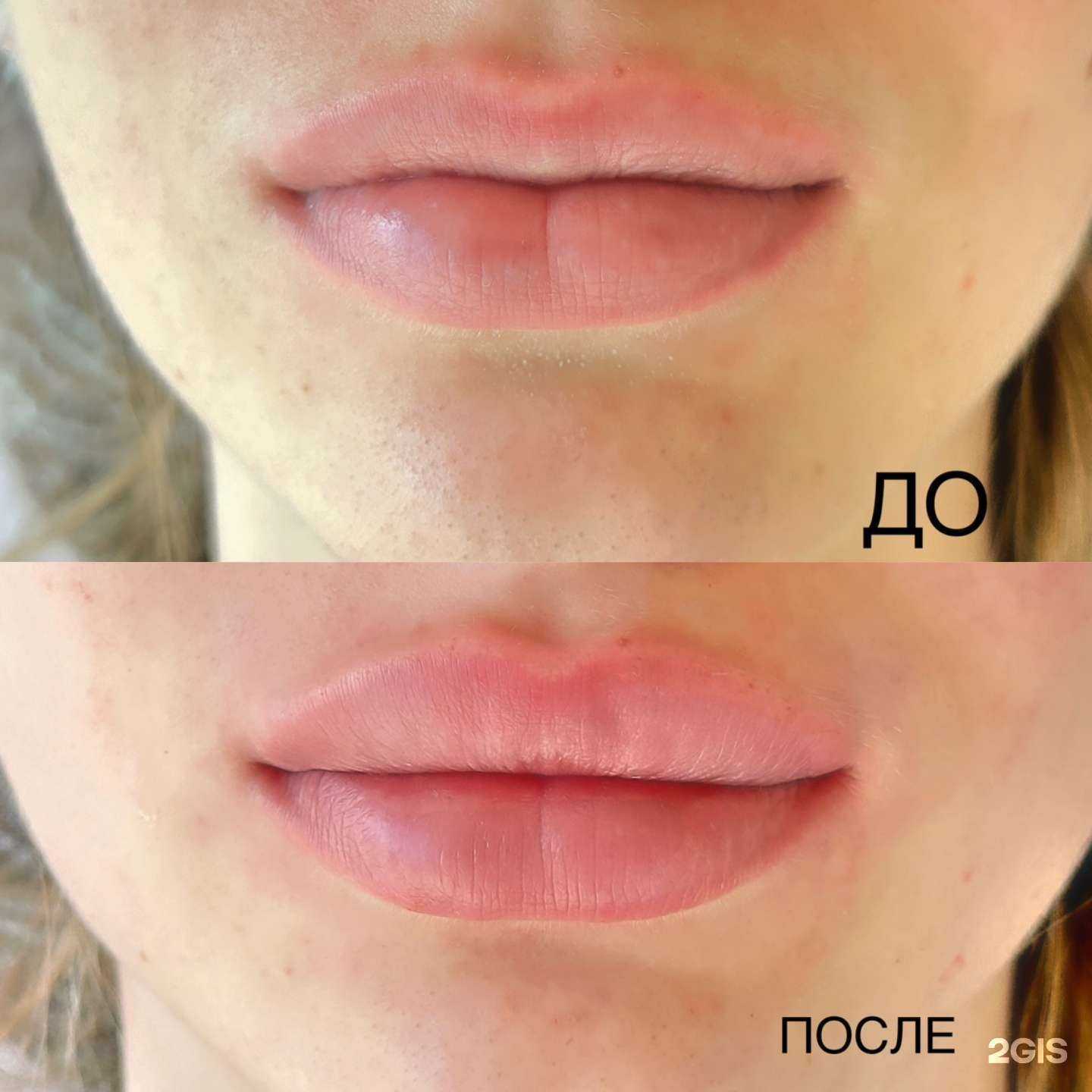 Отзывы на компанию Кабинет косметологии в Майкопе c фото