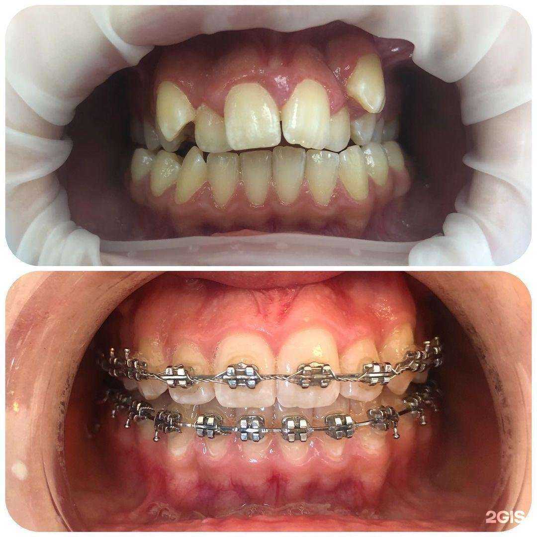 Отзывы на компанию Фэмили Дент в Чебоксарах c фото