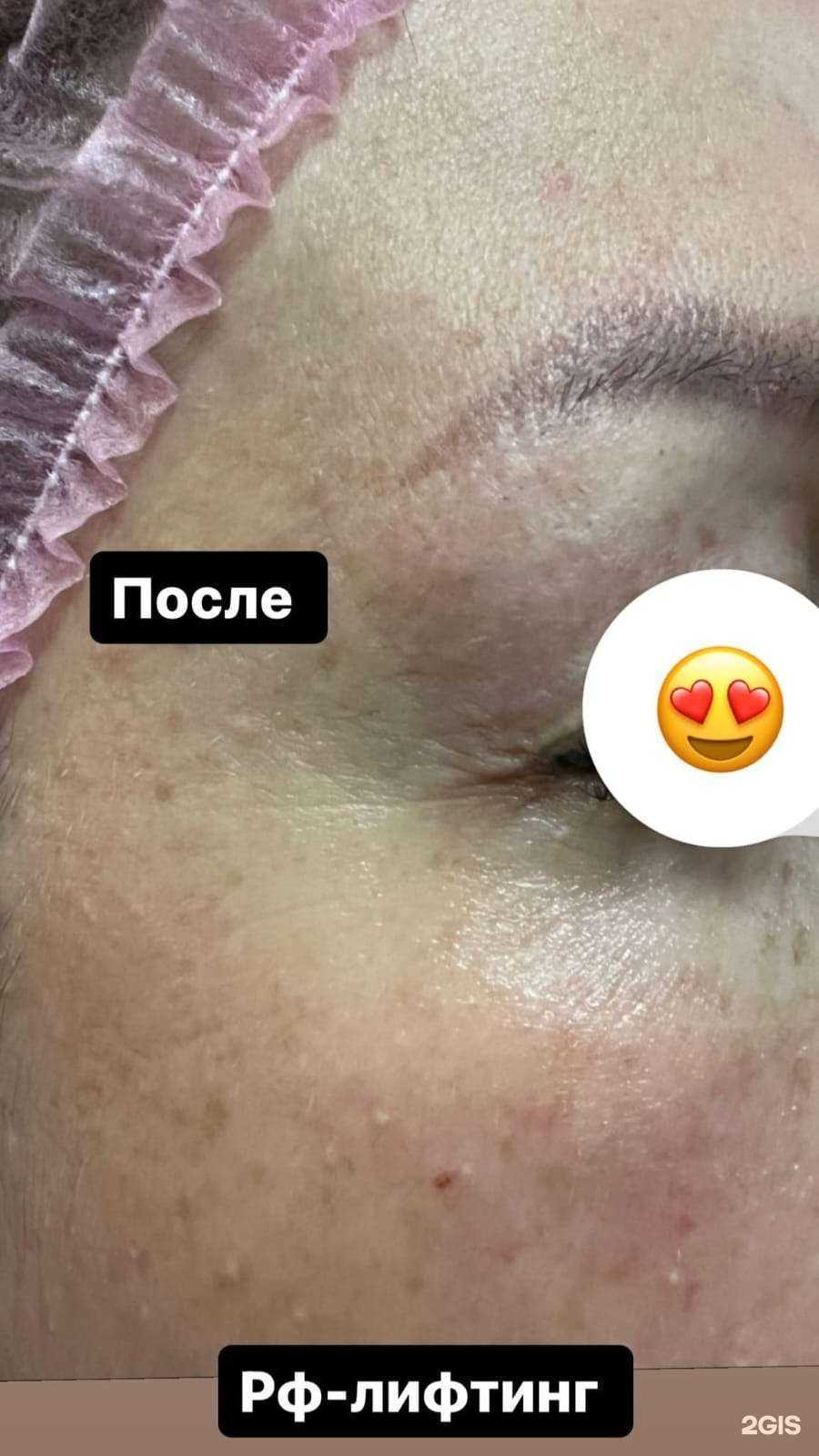 Отзывы на компанию Вишня в г. Хабаровск c фото