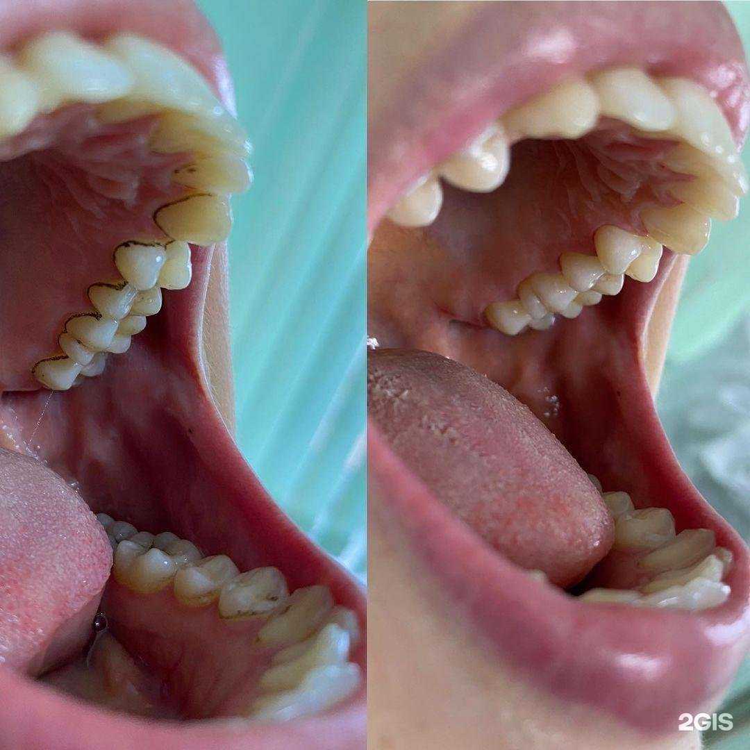 Отзывы на компанию Стоматологический кабинет Муратова Р.И. в г. Крымск c фото