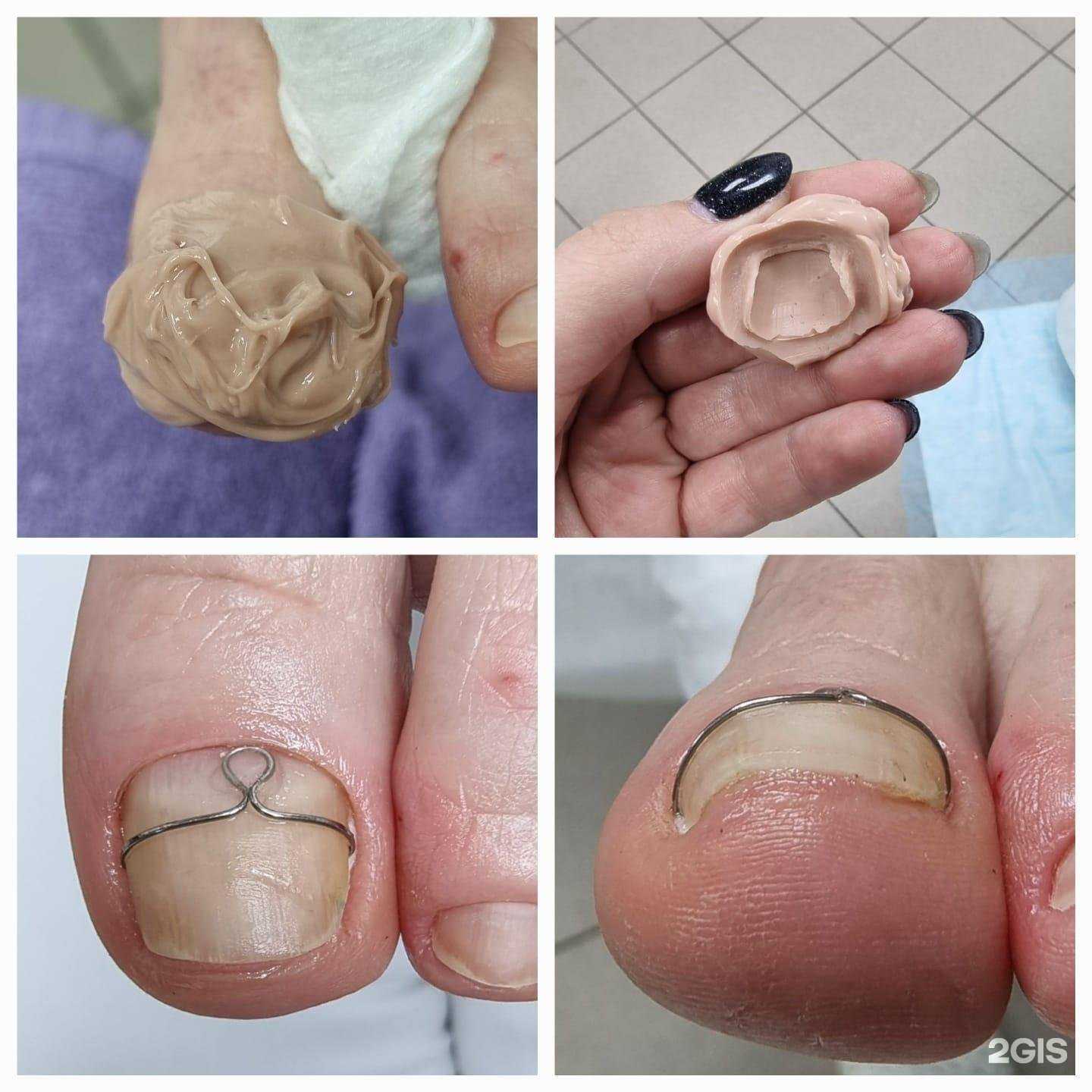 Отзывы на компанию 20 пальцев в Брянске c фото