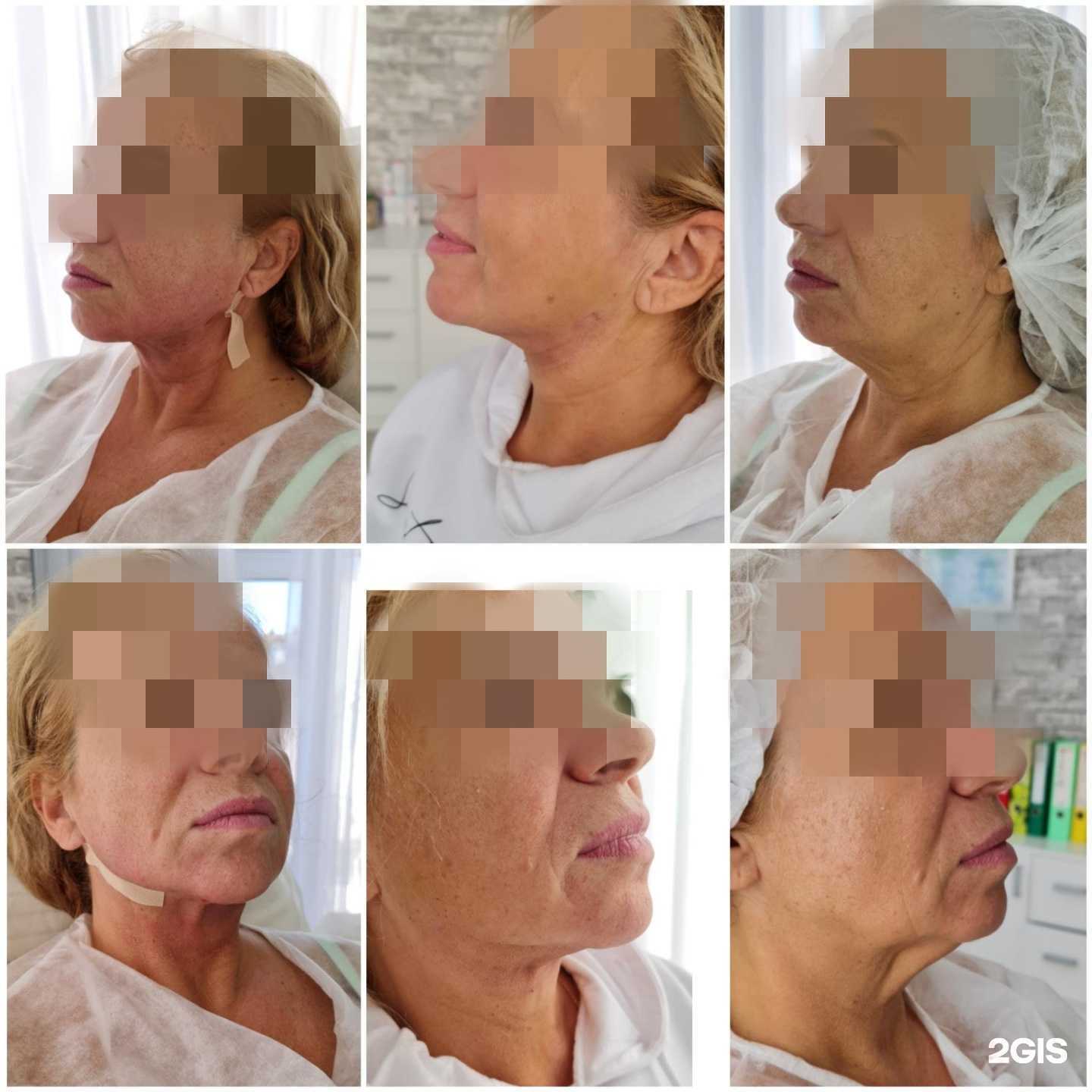 Отзывы на компанию Estet в Сочи c фото