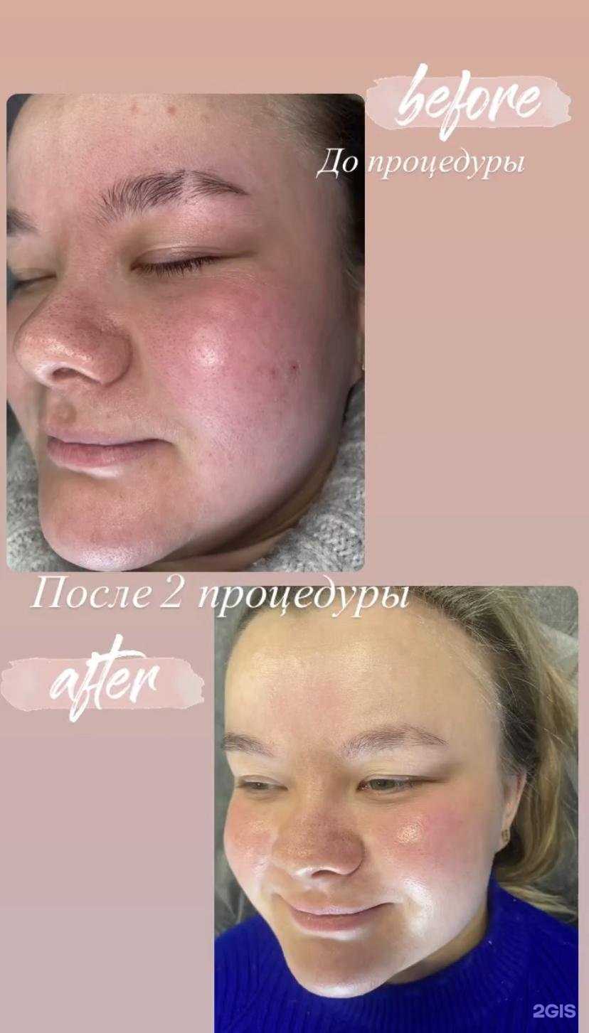 Отзывы на компанию Laser Light в г. Новосибирск c фото