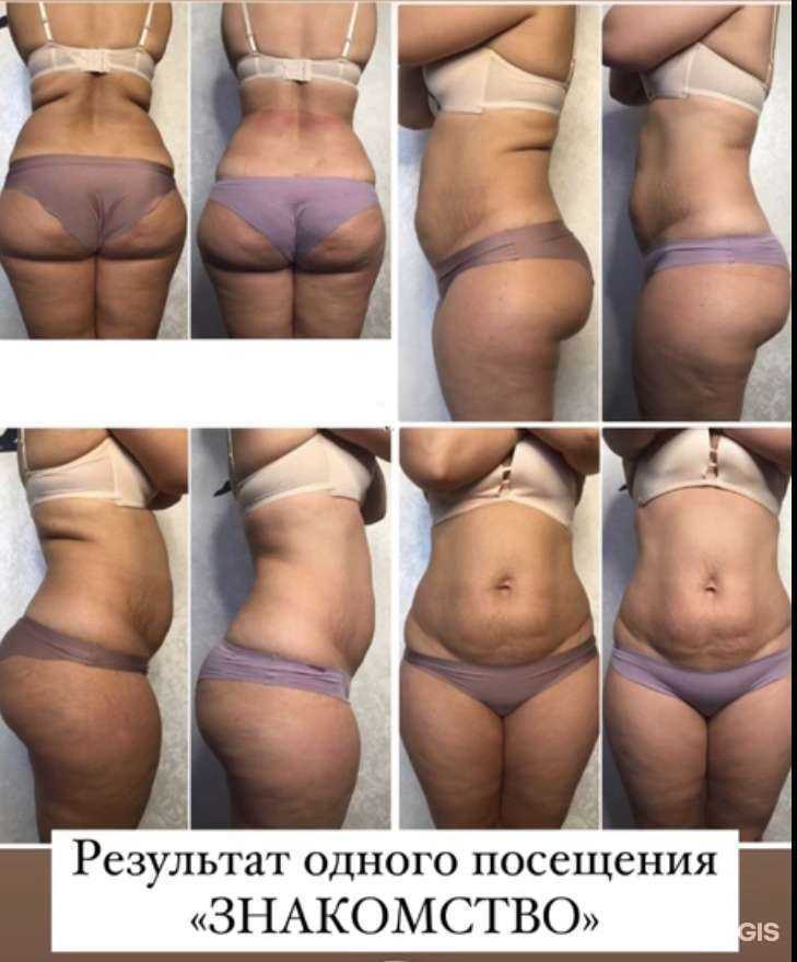 Отзывы на компанию Vi-spa в г. Краснодар c фото