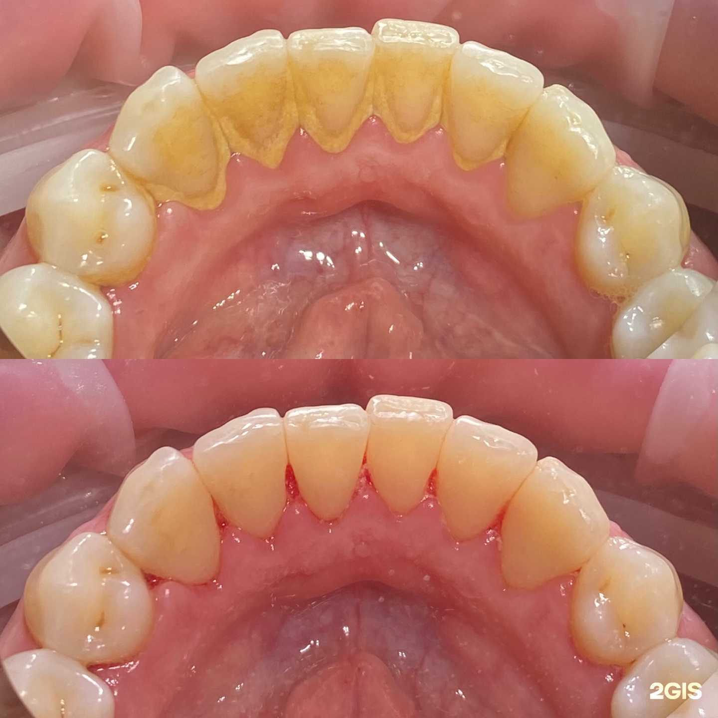 Отзывы на компанию Сити Дент в Туле c фото