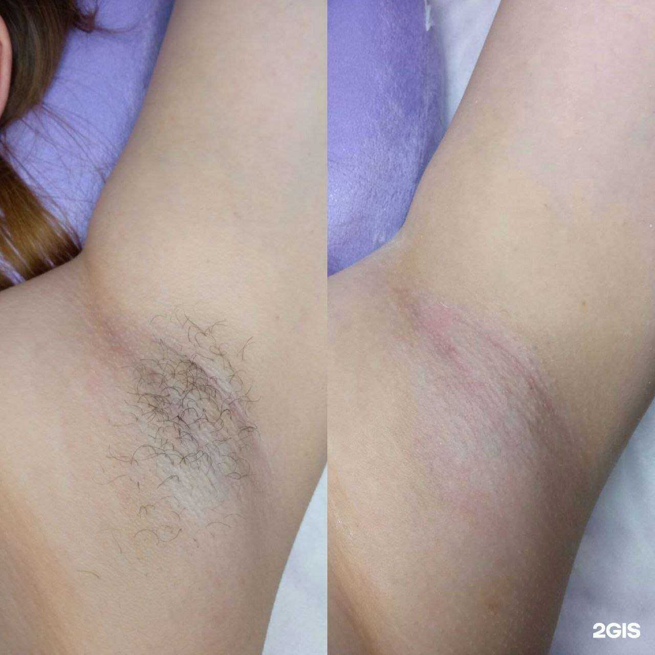 Отзывы на компанию Lыsa Kisa в Ставрополе c фото