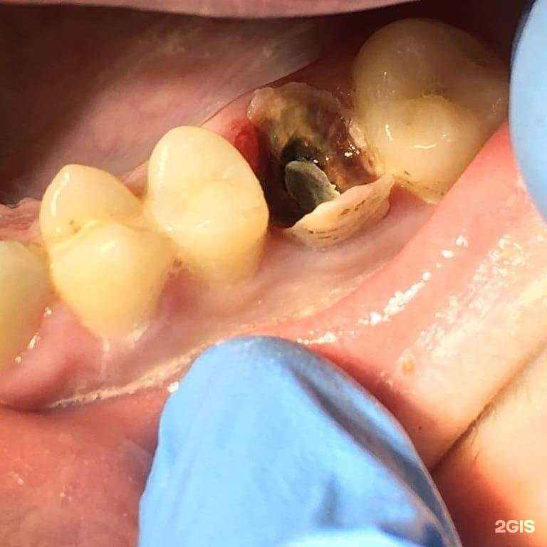 Отзывы на компанию Стоматология в Дербенте c фото