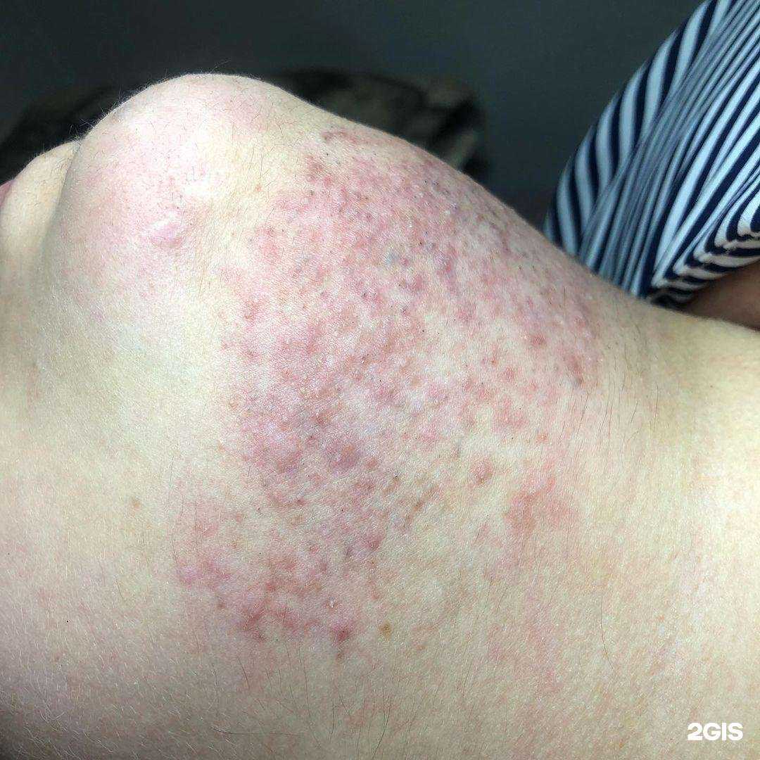 Отзывы на компанию Electroepil_mv в Минеральных Водах c фото