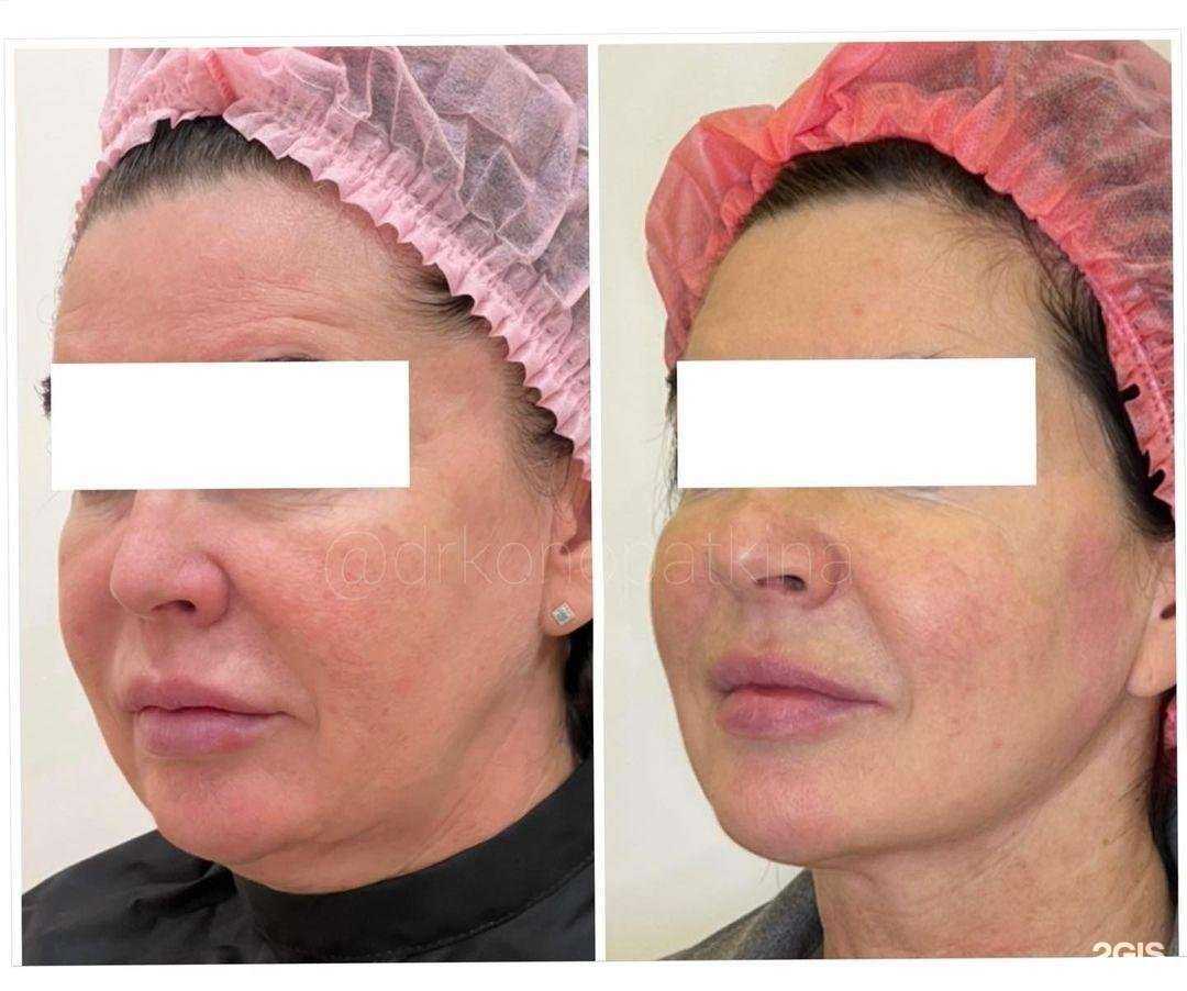 Отзывы на компанию Клиника доктора Конопаткиной в г. Киров c фото