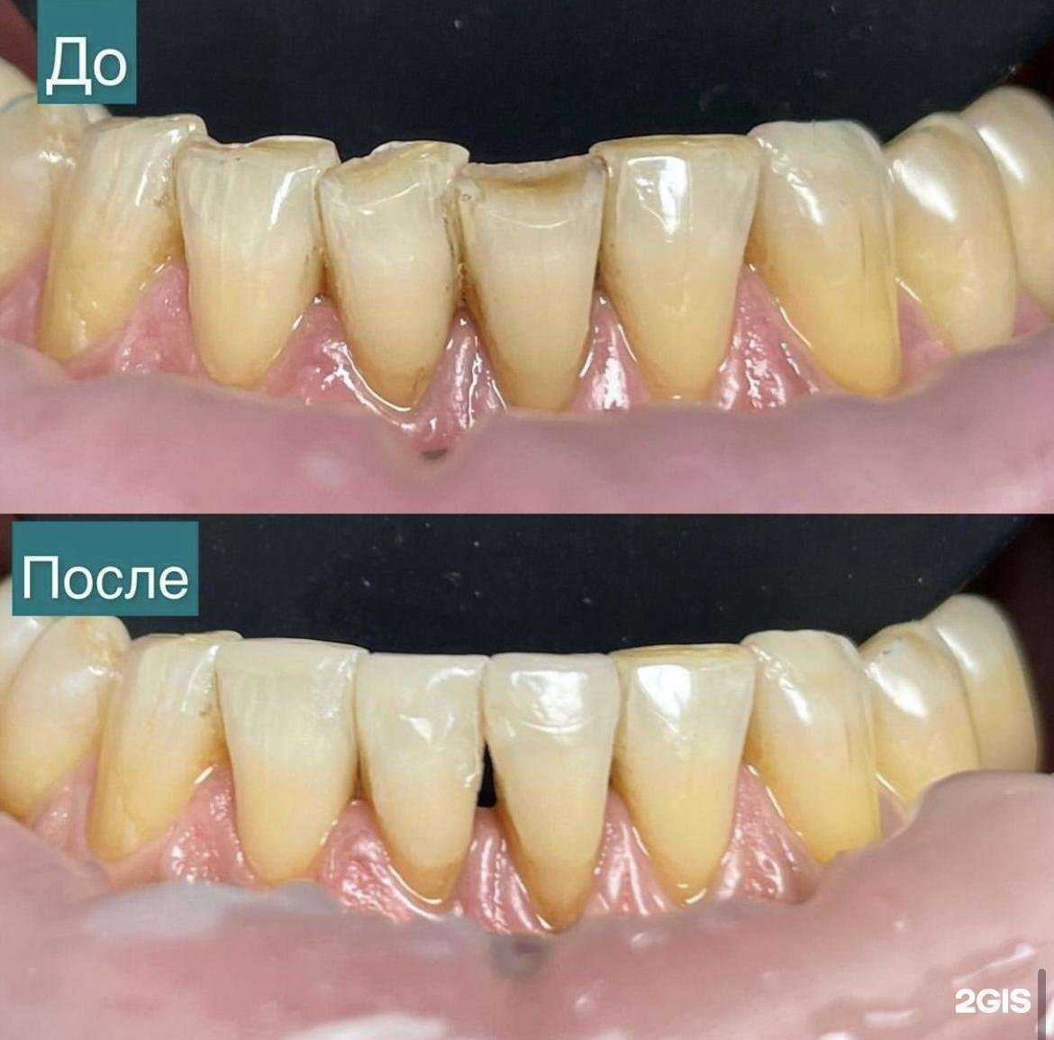 Отзывы на компанию Вита Дент в Хабаровске c фото