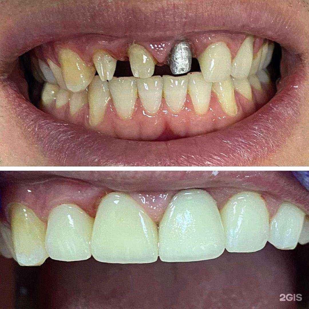 Отзывы на компанию Альфа Dent в г. Махачкала c фото