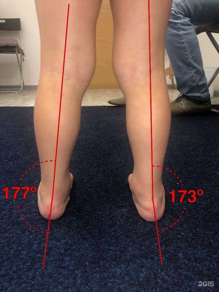 Отзывы на компанию Fiziostep-Orto в г. Казань c фото