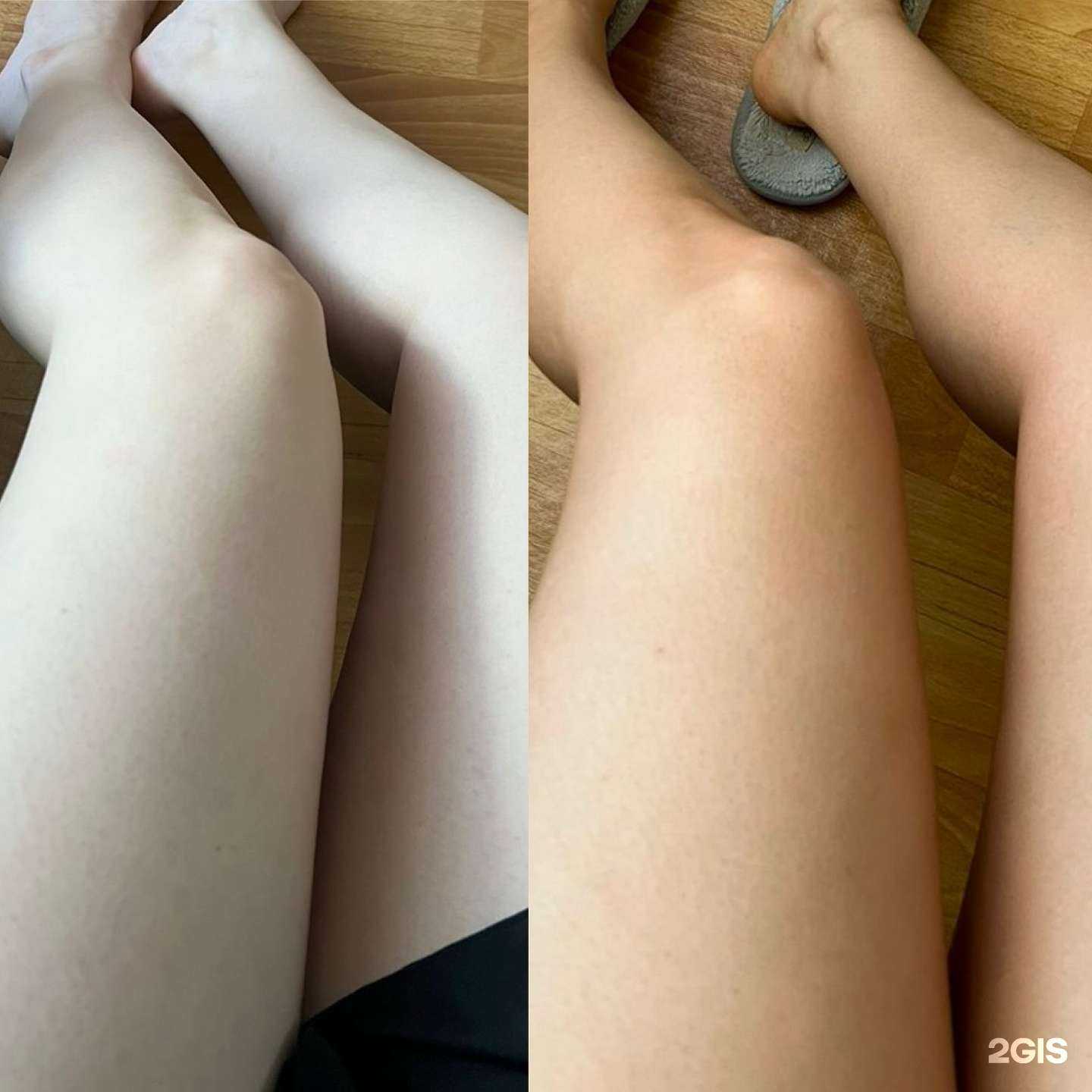 Отзывы на компанию КоролЕвский загар в Королёве c фото